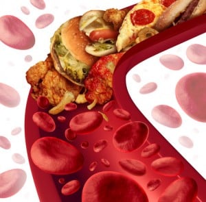 Cholesterol Artery